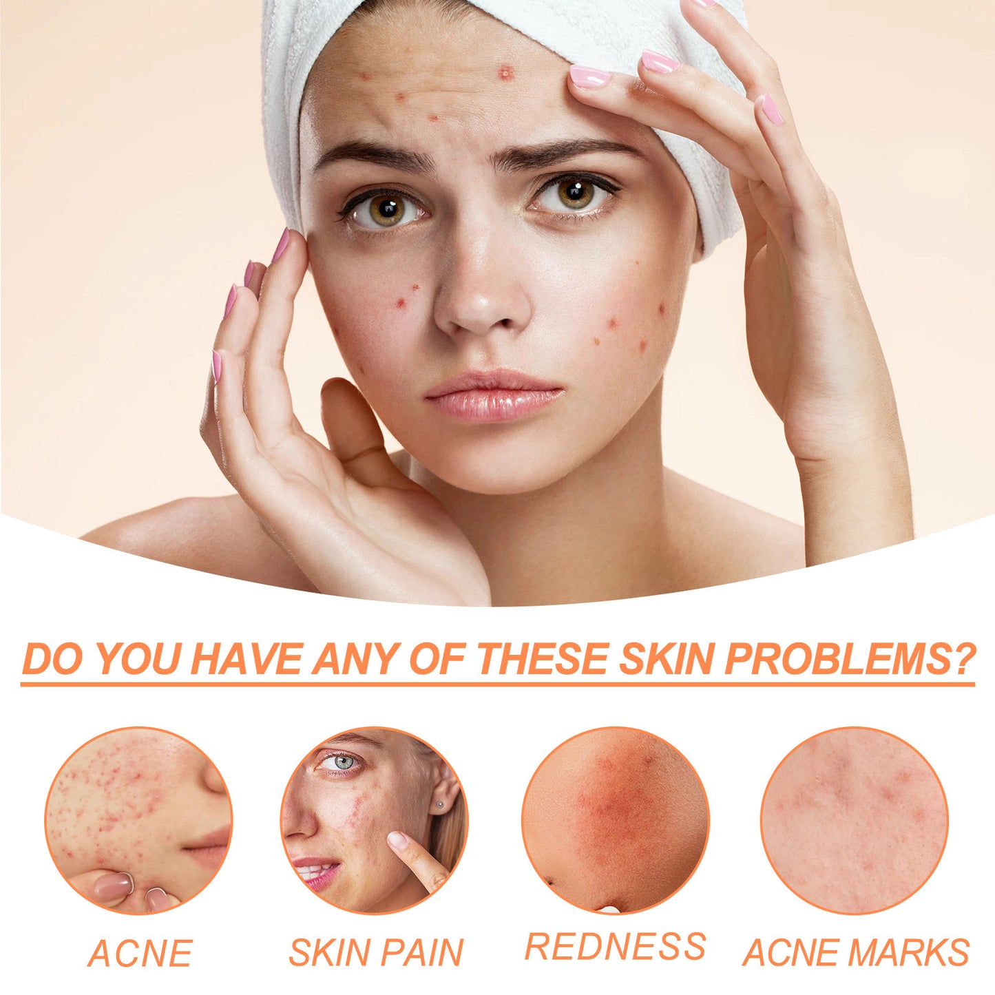 Salicylate Desalting Pimple Acne Marks Gentle And Clean